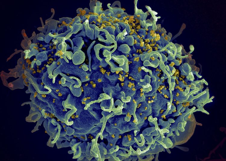 El informe muestra cifras especialmente preocupantes sobre la incidencia del VIH/sida en las mujeres y niñas del África subsahariana, que representaron el 63% de todas las nuevas infecciones por el VIH en 2022. - Fuente externa.