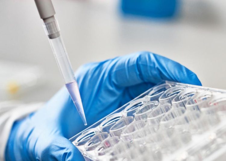 Este importante hallazgo es fruto del trabajo realizado por el grupo de investigación de Bioquímica Aplicada de la Universidad de Alicante - Fuente externa.