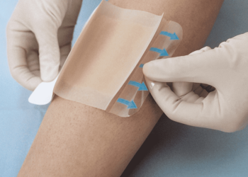En caso de que el apósito pase a color amarillo, su sistema de capas permite añadir una nueva que libera un tipo de antibiótico de uso común sobre la herida para evitar que la infección prospere. - Fuente externa.