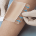 En caso de que el apósito pase a color amarillo, su sistema de capas permite añadir una nueva que libera un tipo de antibiótico de uso común sobre la herida para evitar que la infección prospere. - Fuente externa.