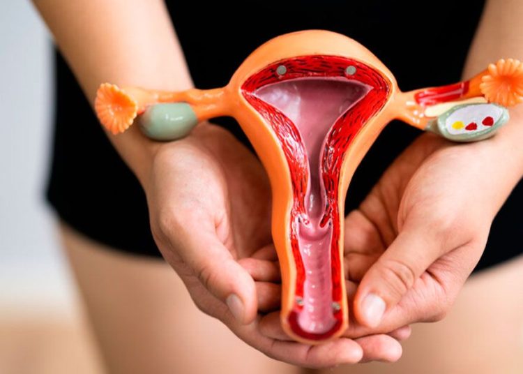 El doctor Héctor Herrera, ginecobstetra de Hospiten Santo Domingo, dijo que el síndrome de “ovario poliquístico” es una enfermedad endocrinológica que se presenta en la edad reproductiva de la mujer.