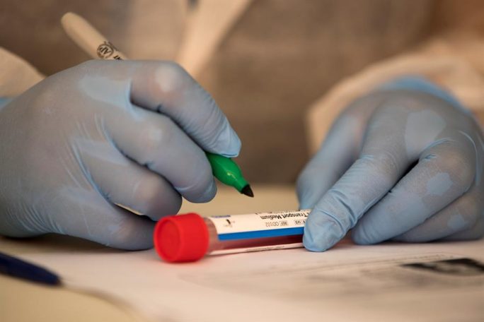 Prueba coronavirus covid-19