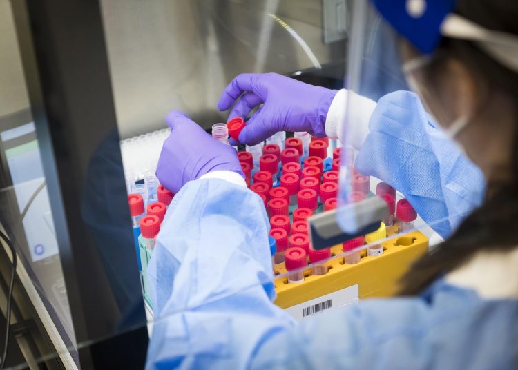 coronavirus covid, pruebas covid