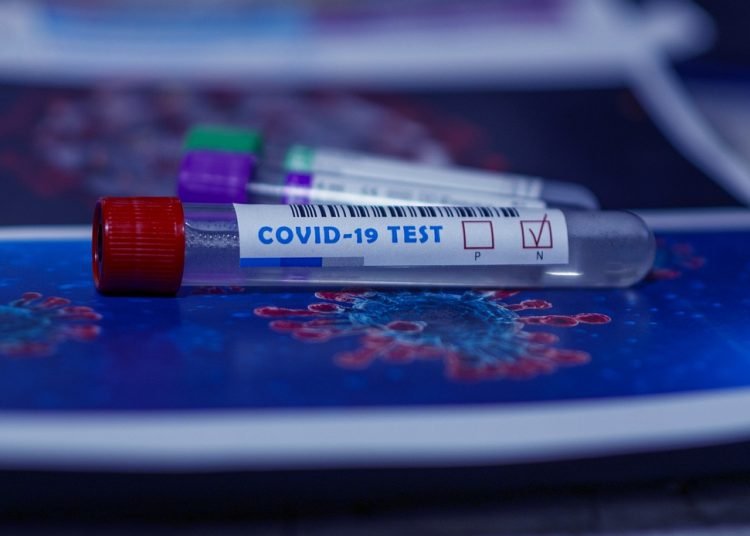 Pruebas diagnósticas coronavirus covid-19