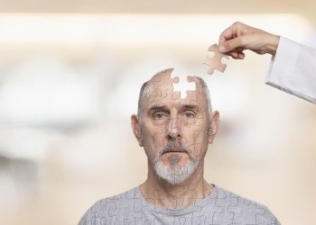 Enfermedad de Alzheimer - Fuente externa.