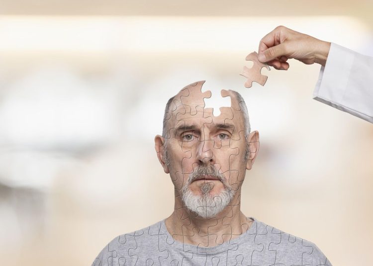 Enfermedad de Alzheimer - Fuente externa.