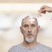 Enfermedad de Alzheimer - Fuente externa.