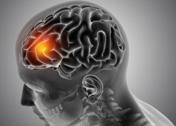 El número de personas que sufren un derrame cerebral, mueren o quedan discapacitadas a causa de esta afección casi se ha duplicado en los últimos 30 años a nivel global. - Fuente externa.