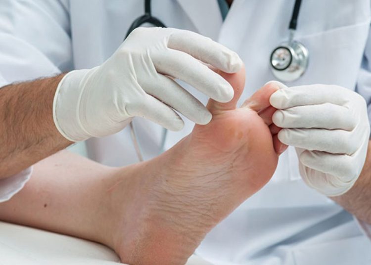 De acuerdo con los especialistas consultados, los pacientes mayores de 50 años son los más frecuentes en acudir a consulas de podología.