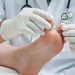 De acuerdo con los especialistas consultados, los pacientes mayores de 50 años son los más frecuentes en acudir a consulas de podología.