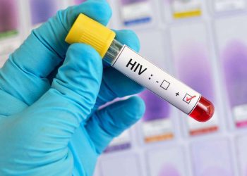 El director ejecutivo de Conavihsida, Enrique González, informa qué alrededor de 85,000 personas viven con el virus en República Dominicana.