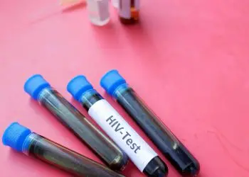 En los últimos cinco años se han registrado las cifras más bajas de decesos por esta enfermedad.